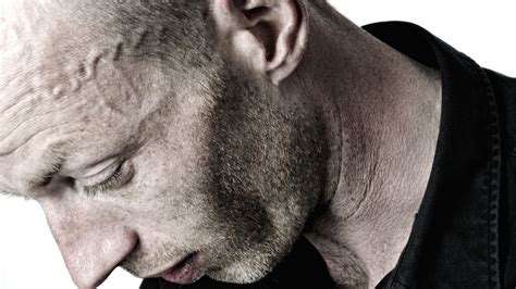 Understanding and Addressing a Bulging Forehead Vein