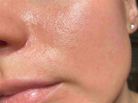 Unlocking Smoother Skin: Effective Strategies to Minimize Facial Pores