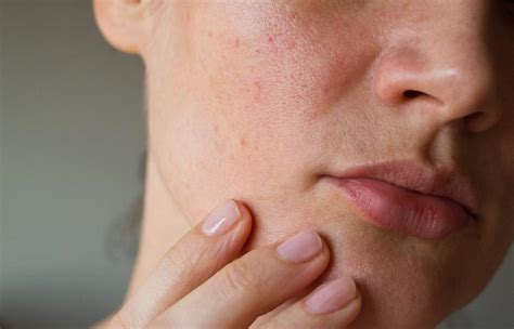 Embrace Comfort: Your Definitive Guide to Managing Sensitive Skin Effectively