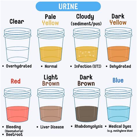 Understanding Urine Colors: What Your Pee Says About Your Health