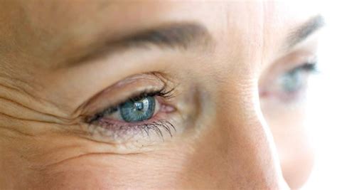 Reclaim Your Radiance: Effective Strategies to Reduce Crows Feet