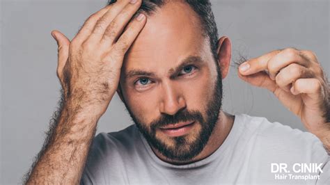 Overcoming Hair Pulling Disorder: A Comprehensive Guide to Stopping Trichotillomania