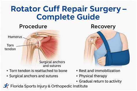 The Road to Recovery: How Long Does Rotator Cuff Surgery Rehabilitation Take?