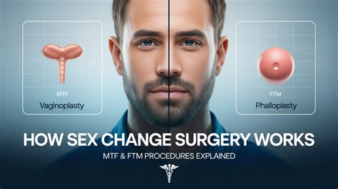 Understanding Gender Affirmation Surgery: A Journey to Authenticity