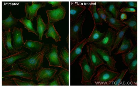Unlocking Immune Secrets: The Power of STAT1 Antibodies in Research