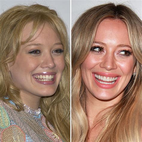 Unforgettable Teeth Transformations: Real Stories of Confident Smiles